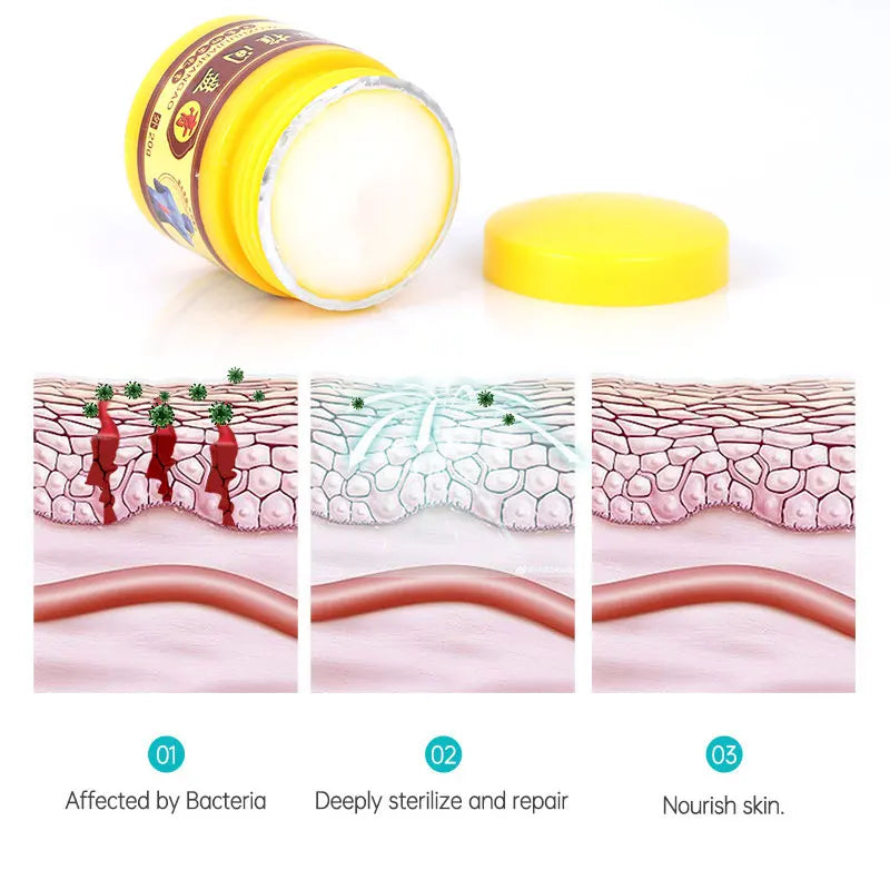 Herbal Lumbar Disc Herniation Ointment