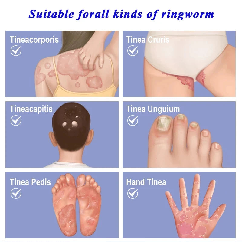 Anti-itching Care Herbal Cream