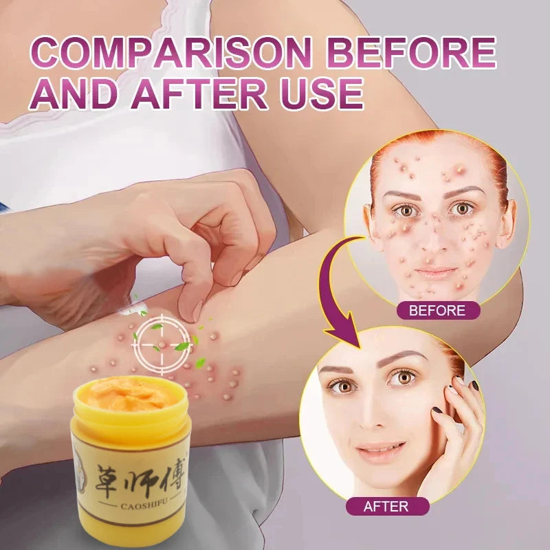 Anti-itching Care Herbal Cream