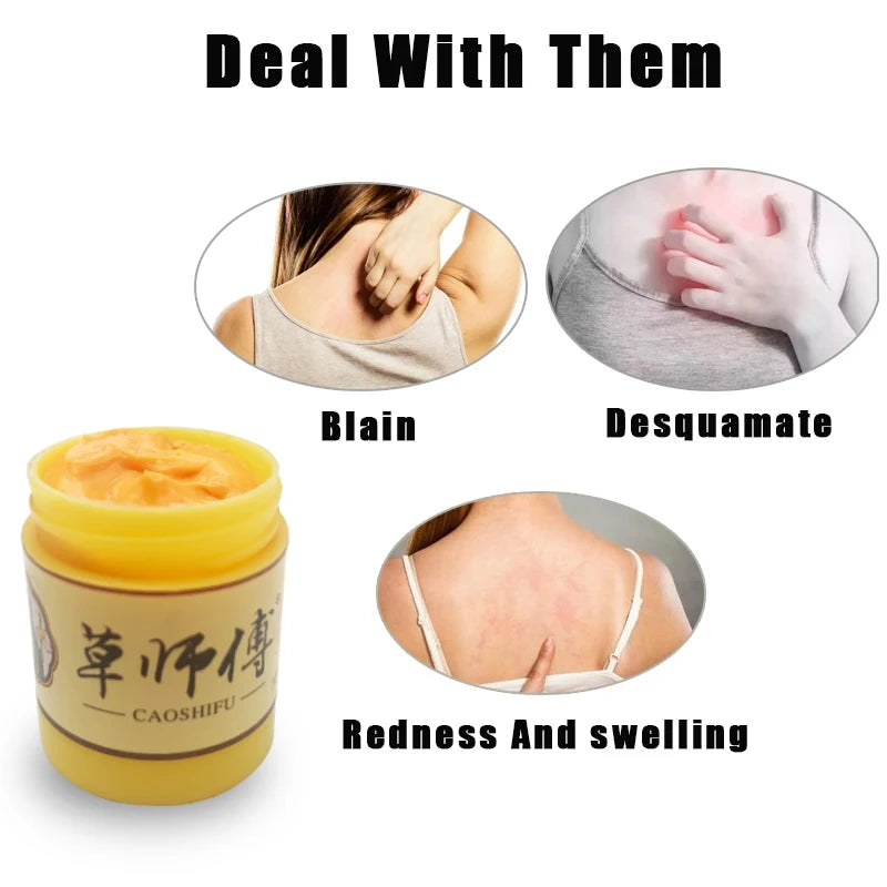 Anti-itching Care Herbal Cream